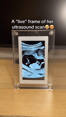 7-Inch Smart Digital Photo Frame | Photo & Video Album with Calendar