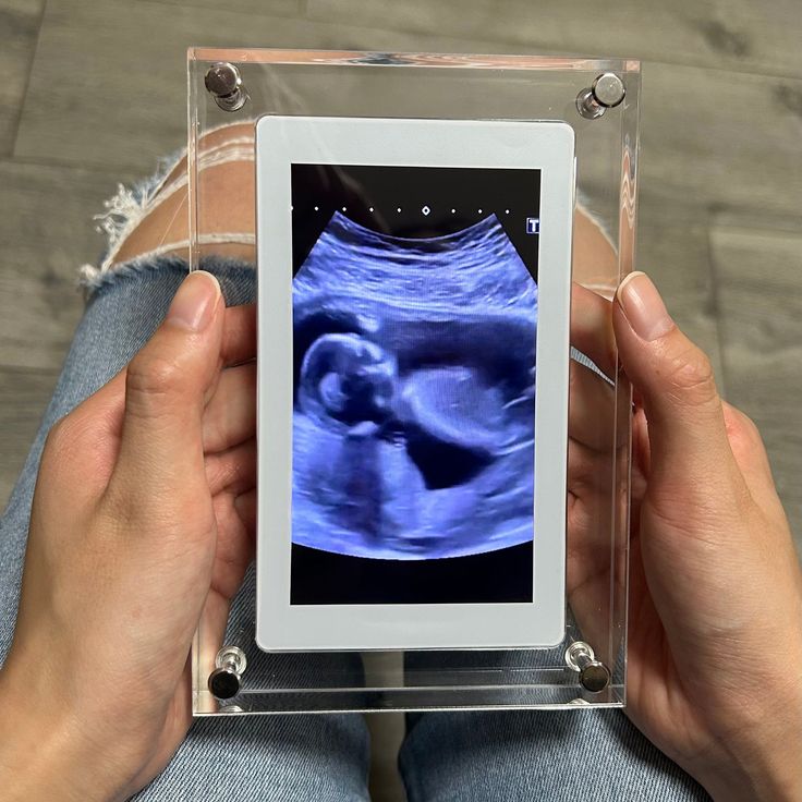 5-inch Transparent Fashion Digital Electronic Photo Album Video Advisement Player Business Gift Photo Frame